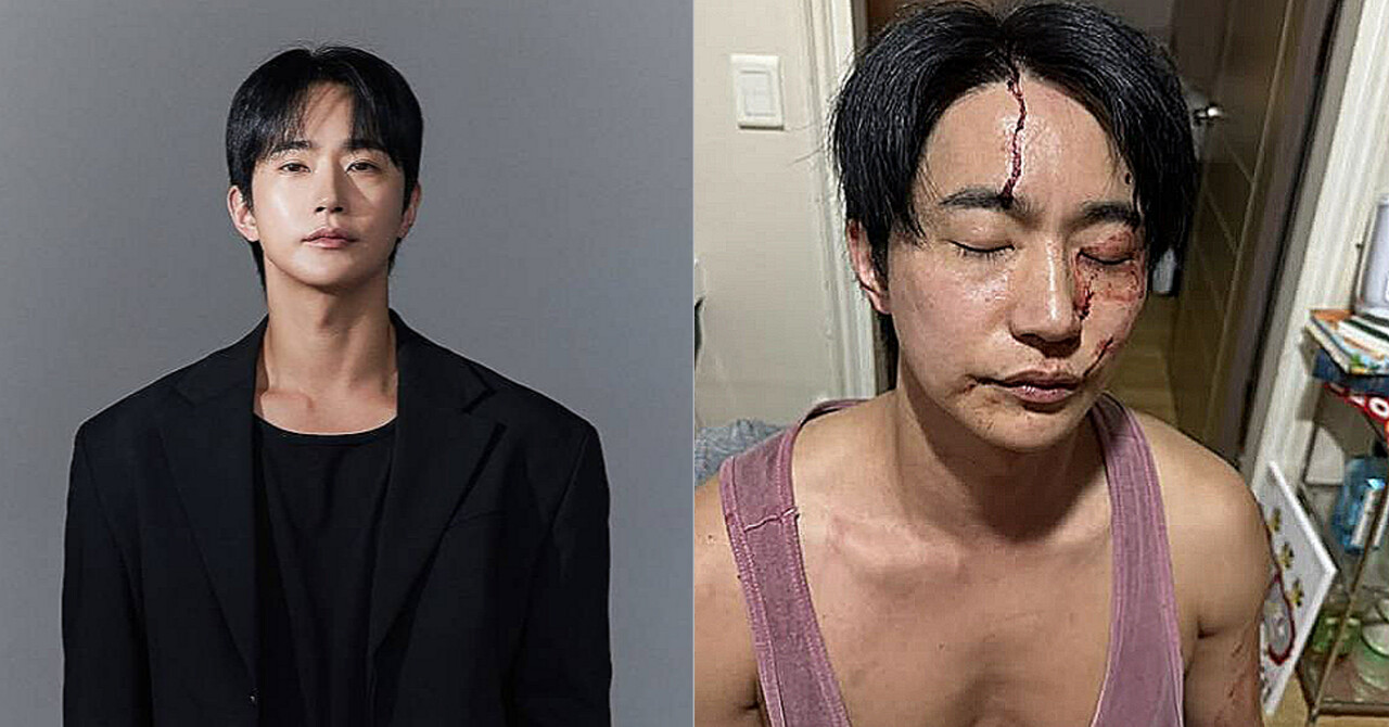 전호준 전 연인 “결혼 빙자·폭행 피해”…전호준 “사실 아냐” 정면 반박