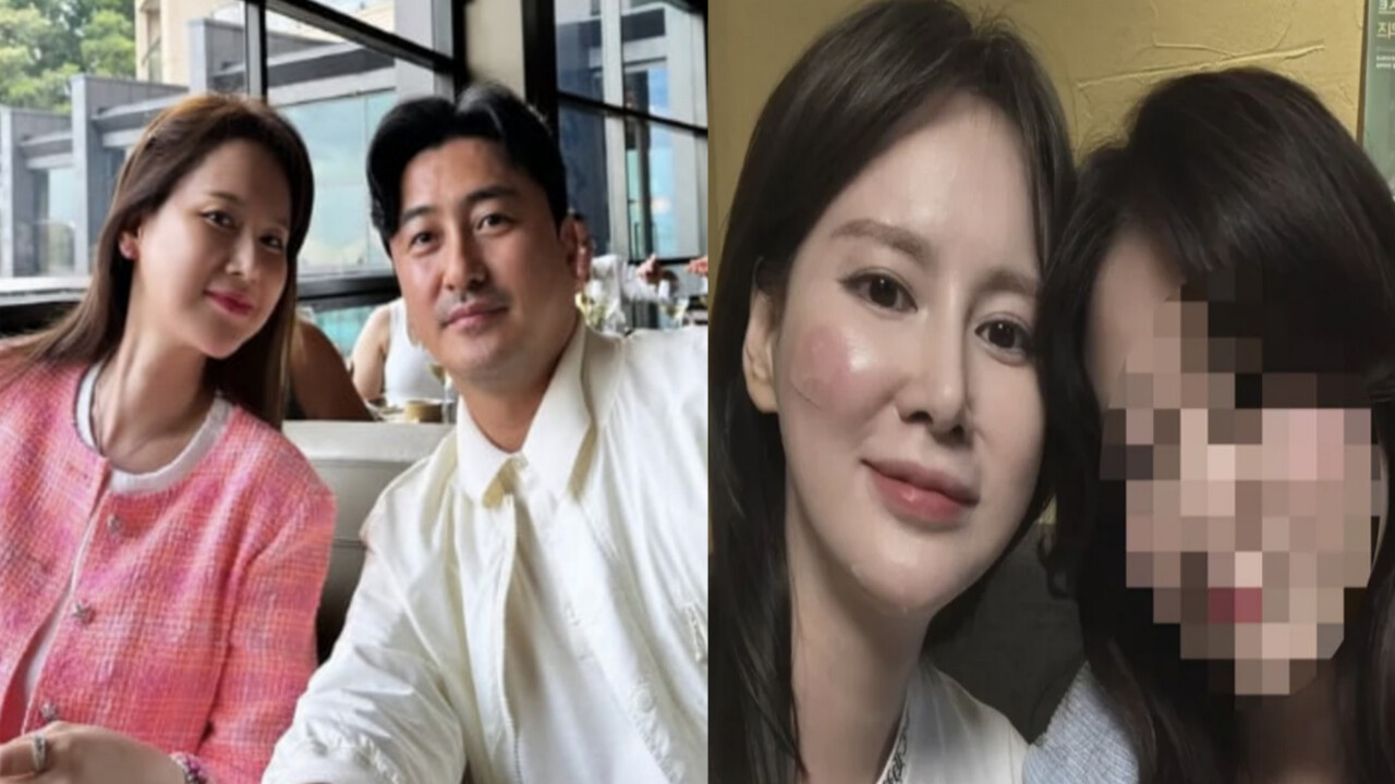 이혜원 '머리 추락' 충격, 얼굴·다리 중상