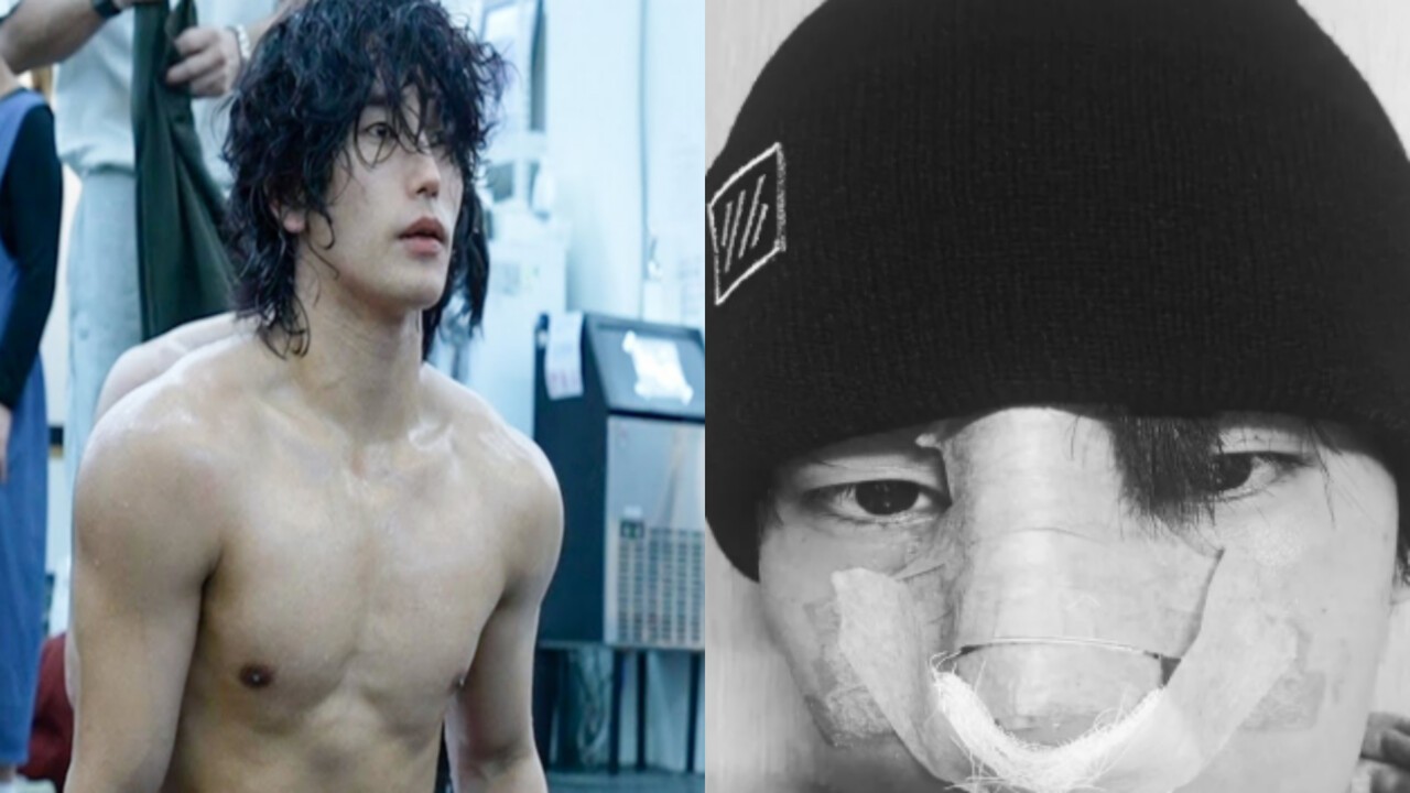 대표 이미지