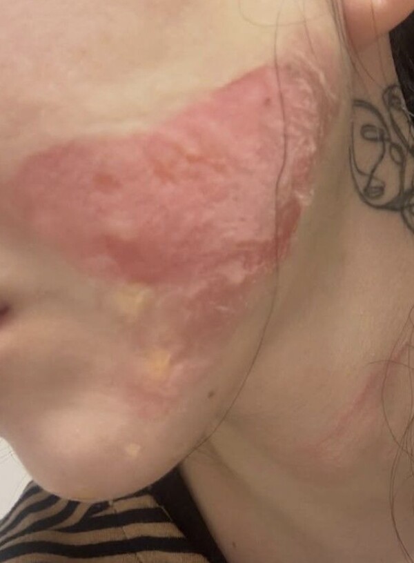 권민아 인스타그램